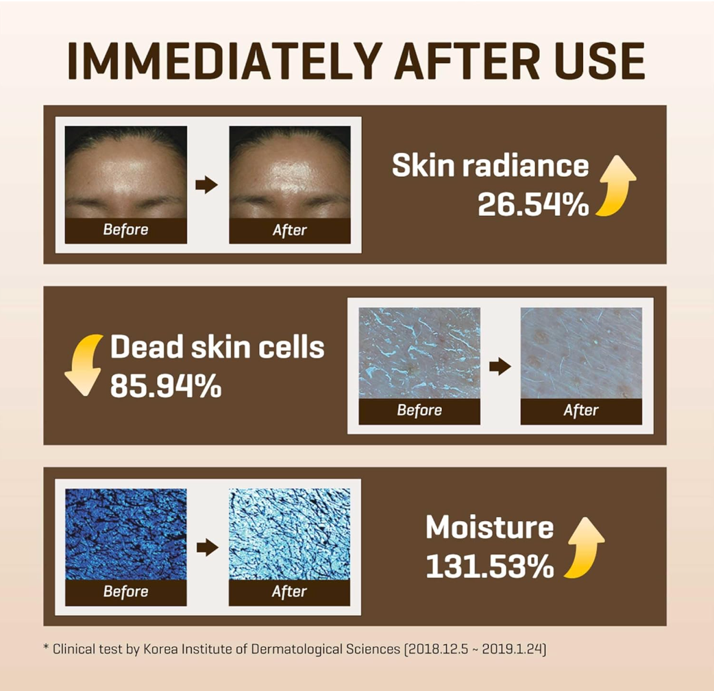 Some By Mi - Galactomyces Pure Vitamin C Glow Toner - Tonic with Vitamin C and Mushroom Filtrate - 200ml, Korean skincare