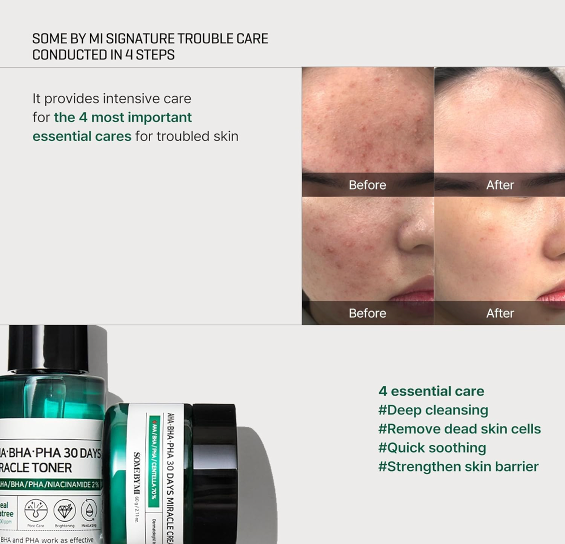 Some By Mi - AHA BHA PHA 30 Days Miracle Starter - Cosmetic Care Kit with AHA, BHA, PHA acids, Korean skincare